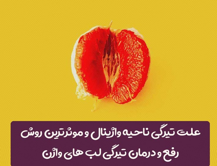 علل تیرگی واژن