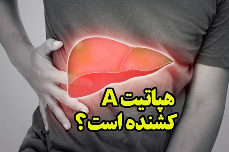  علائم هپاتیت A: عفونت شدیدا مسری کبد